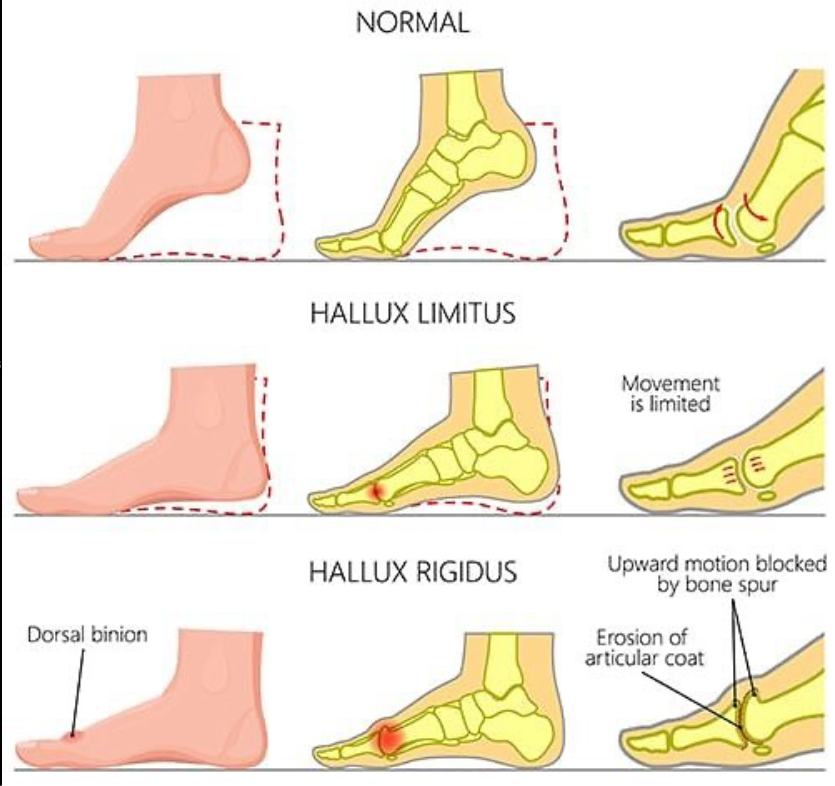 Dr. Muhammed - “Foot health matters! Let’s explore the differences ...