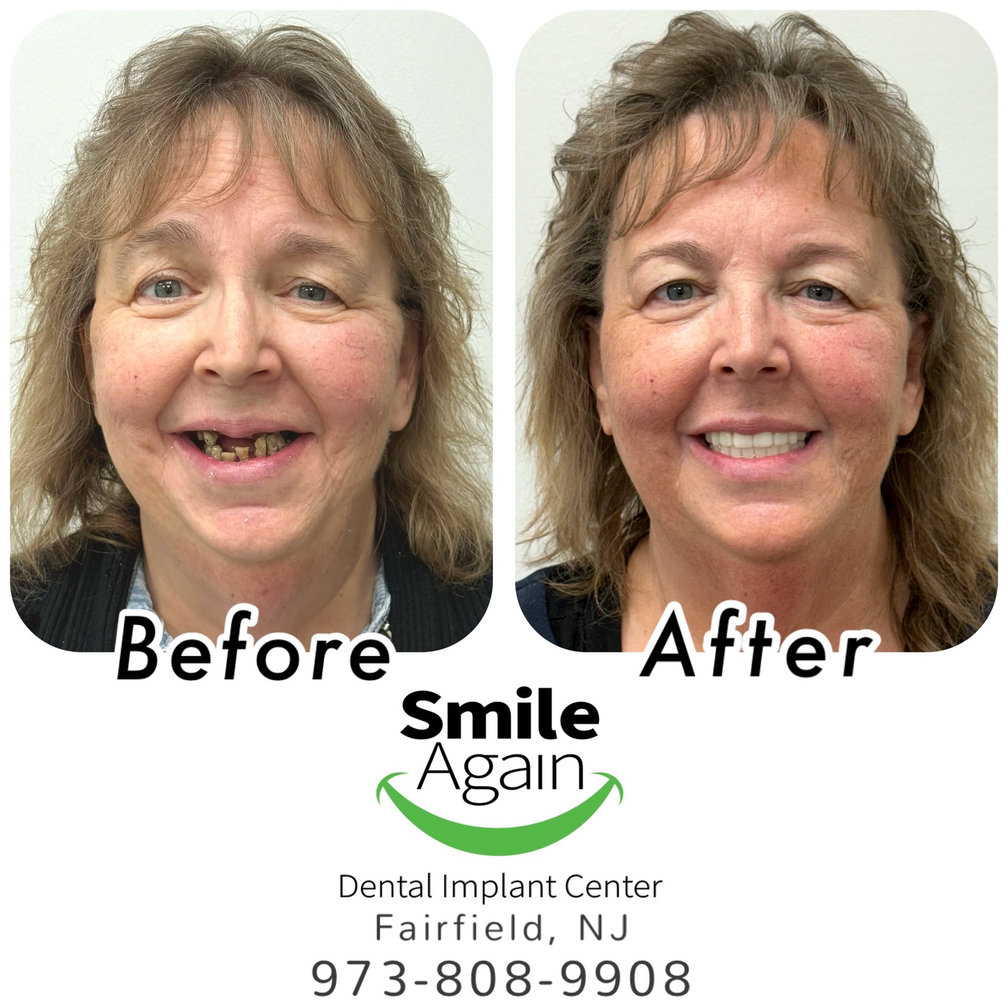 Smile Again Dental Implant Center | Fairfield NJ