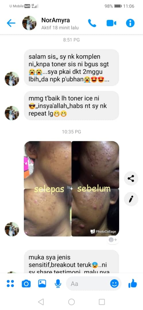 Biar Harga Budak Sekolah Jus Kunyit Malika Penang Kedah Facebook