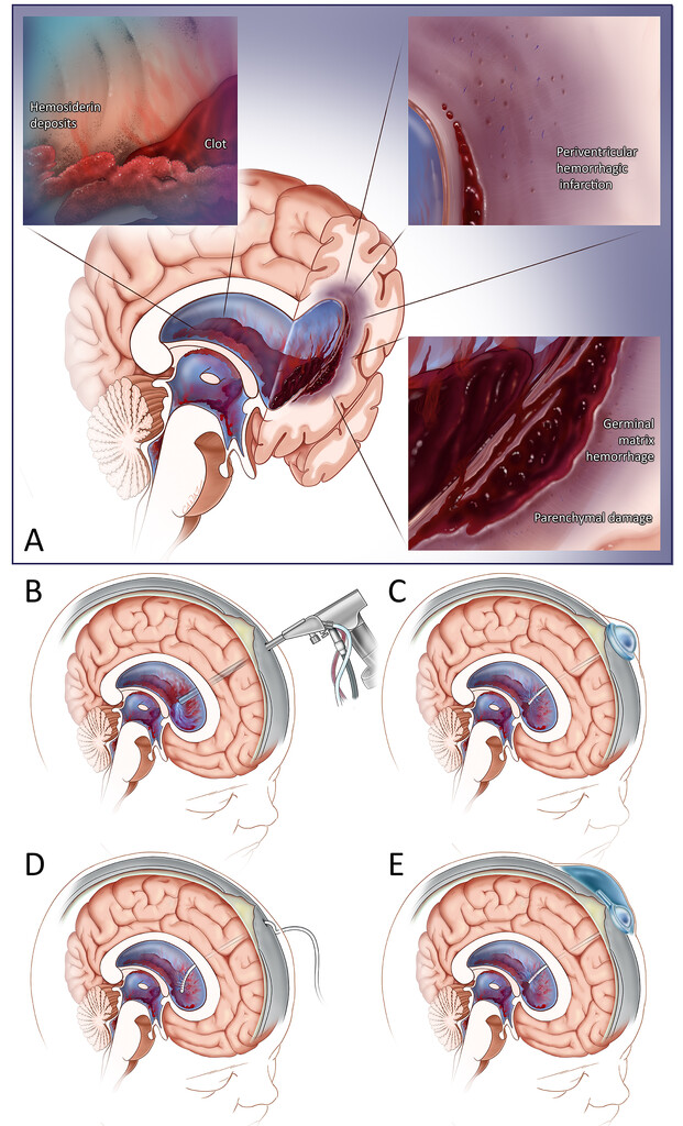 Journal of Neurosurgery Publishing Group - #OnlineFirst: Structural ...