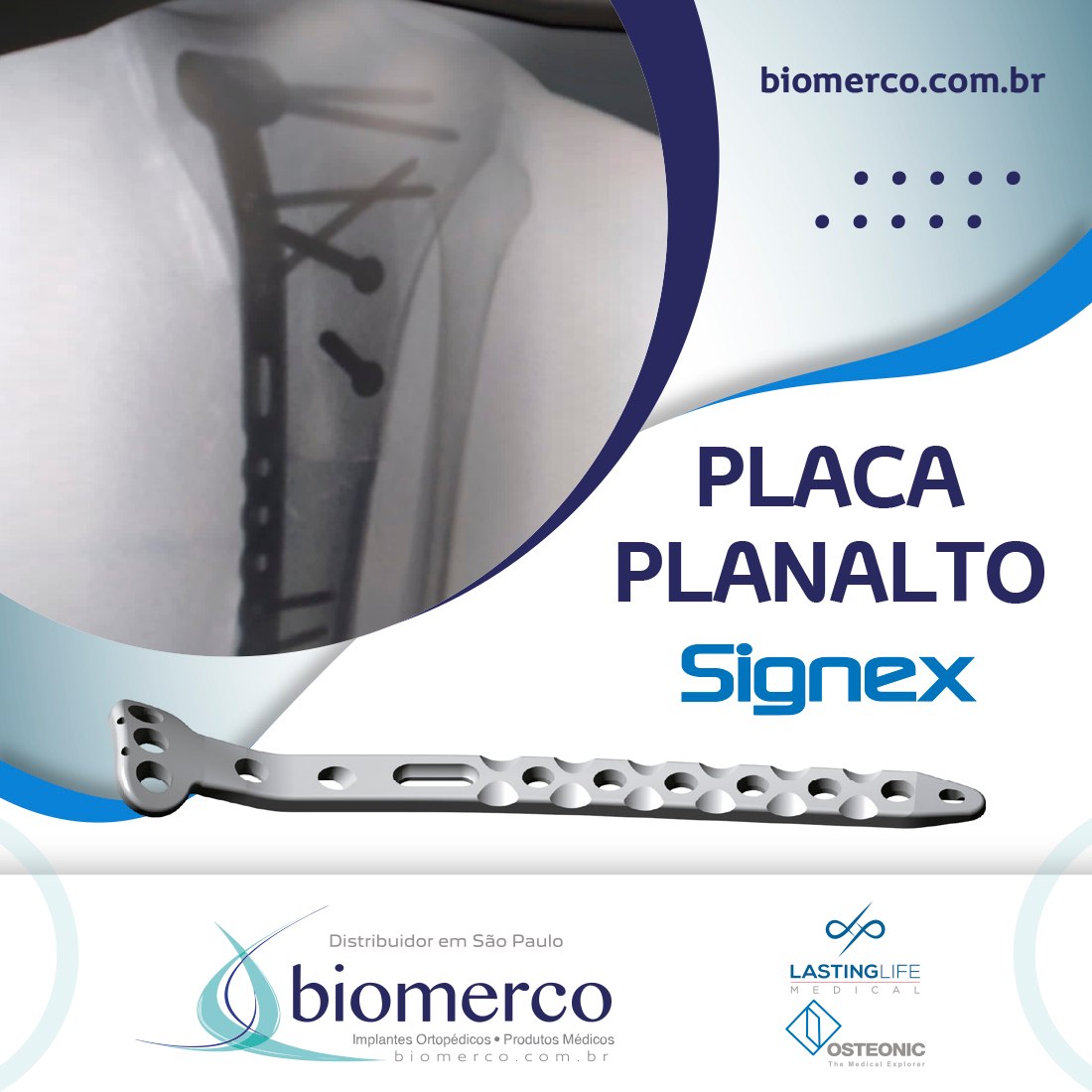 Biomerco - Conheça o nosso sistema Signex Proximal Medial...