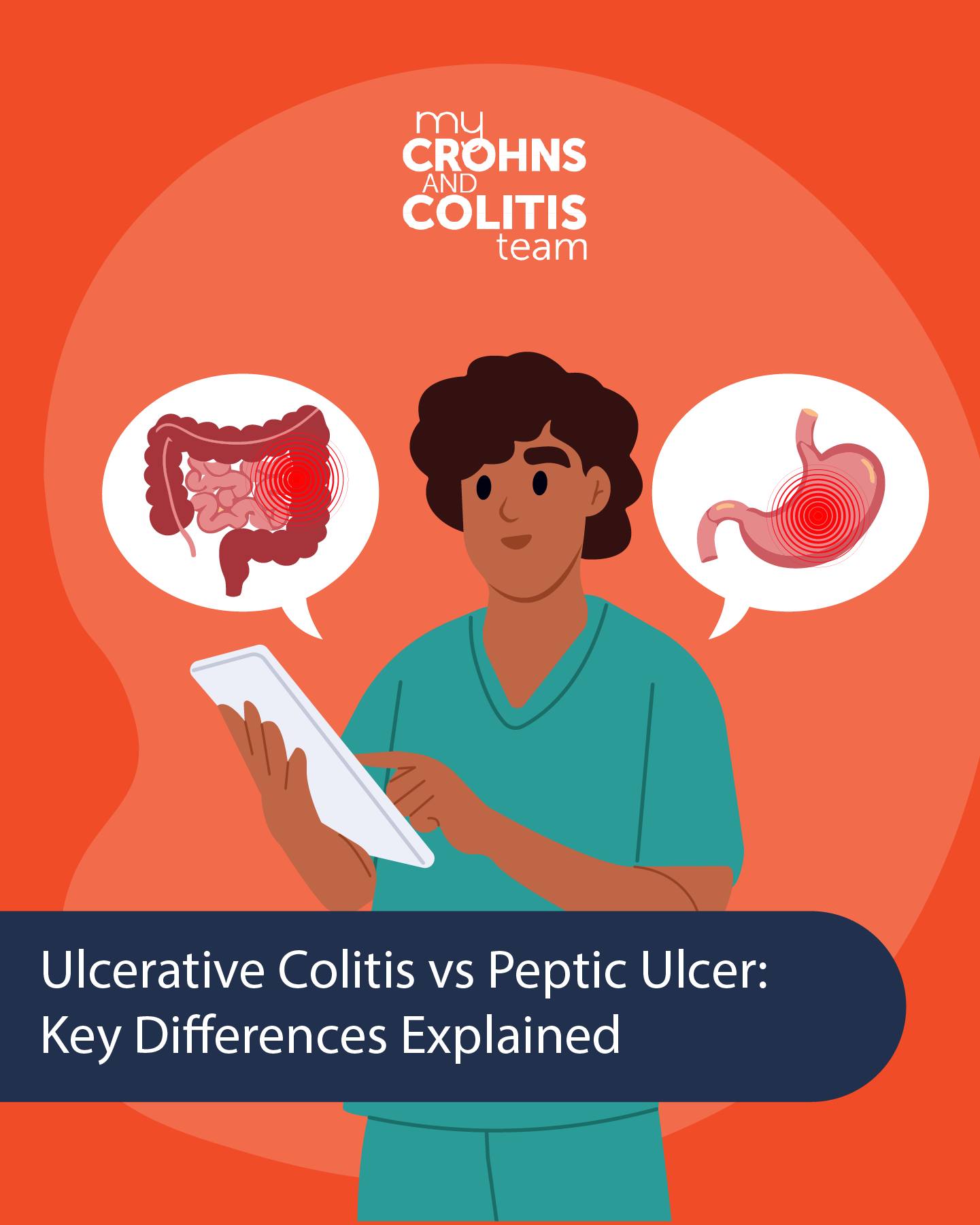 MyCrohnsTeam - Ulcerative colitis and peptic ulcers both cause stomach ...