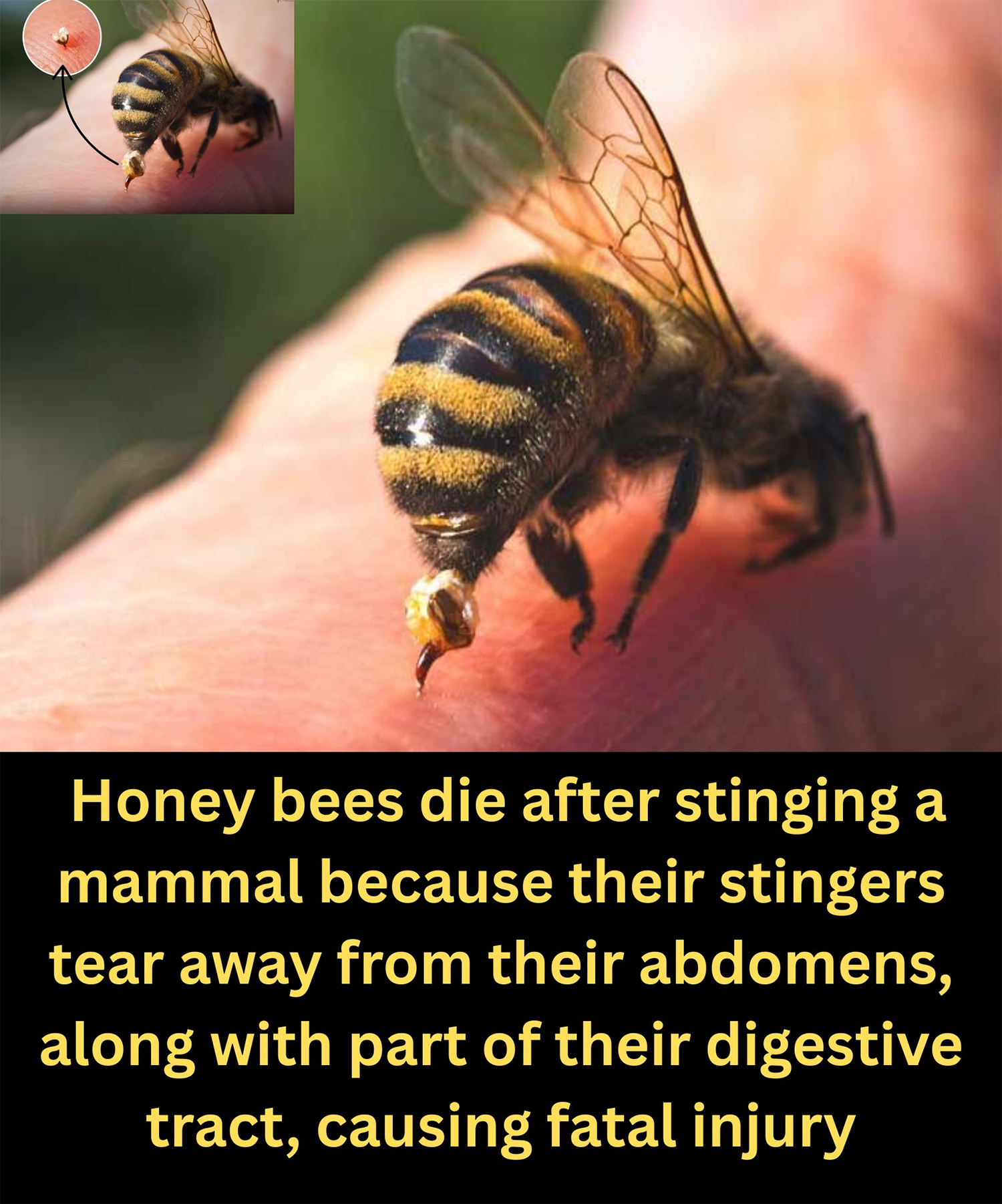 Some - 🐝 Deadly Sacrifice: The Honey Bee’s Ultimate Defense 💥 Worker ...