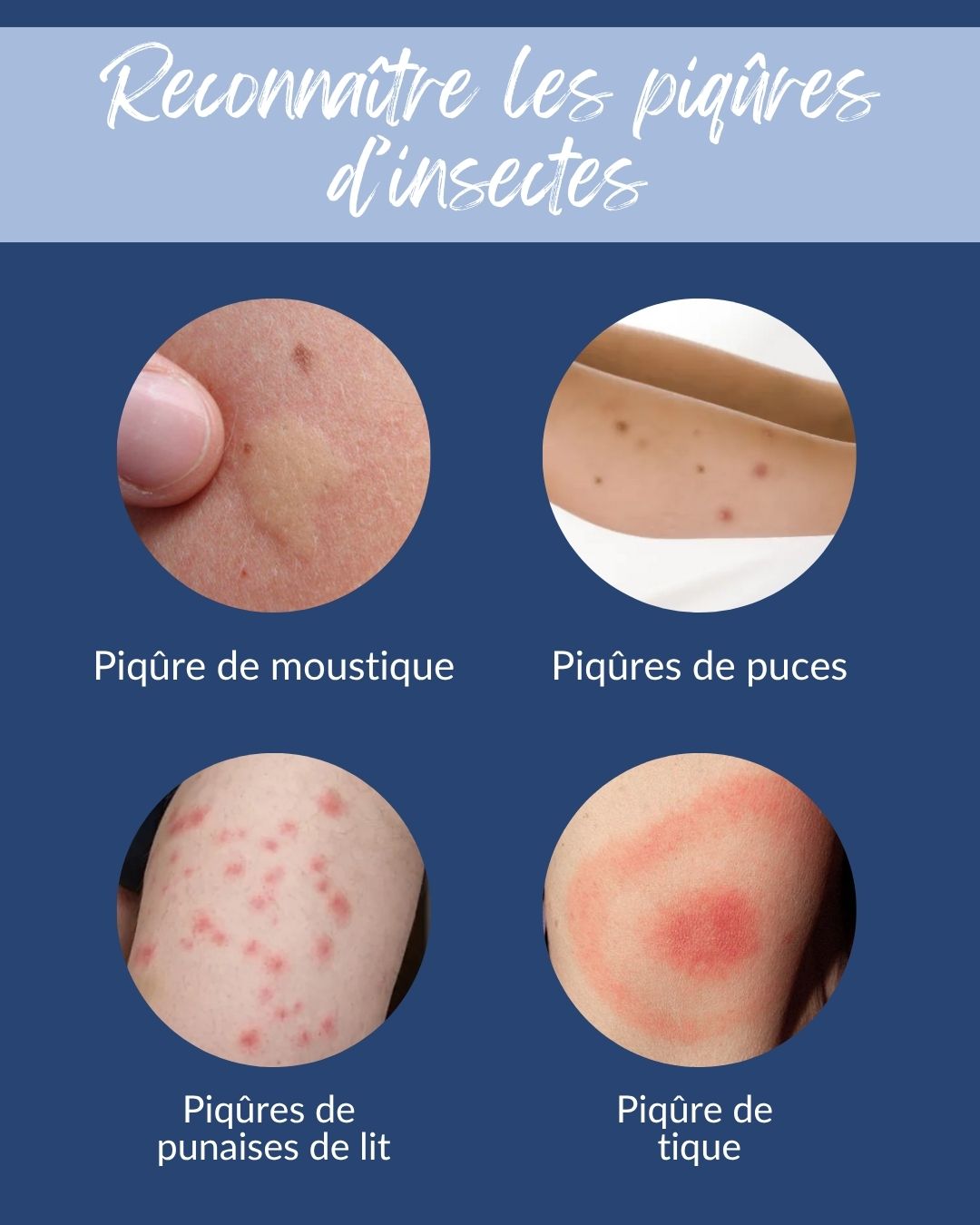 Pharmacie - 🔍 Comment reconnaître les piqûres d’insectes ? Moustique ...