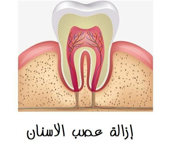 مركز الدكتور عزام أبو صفية سحب العصب هو أحد الإجراءات الطبية اللازمة لعلاج الأسنان ويلجأ الطبيب إلى هذا العلاج لإنقاذ سن أوشك أن يتآكل من التسوس أو في حالة إنقاذ السن