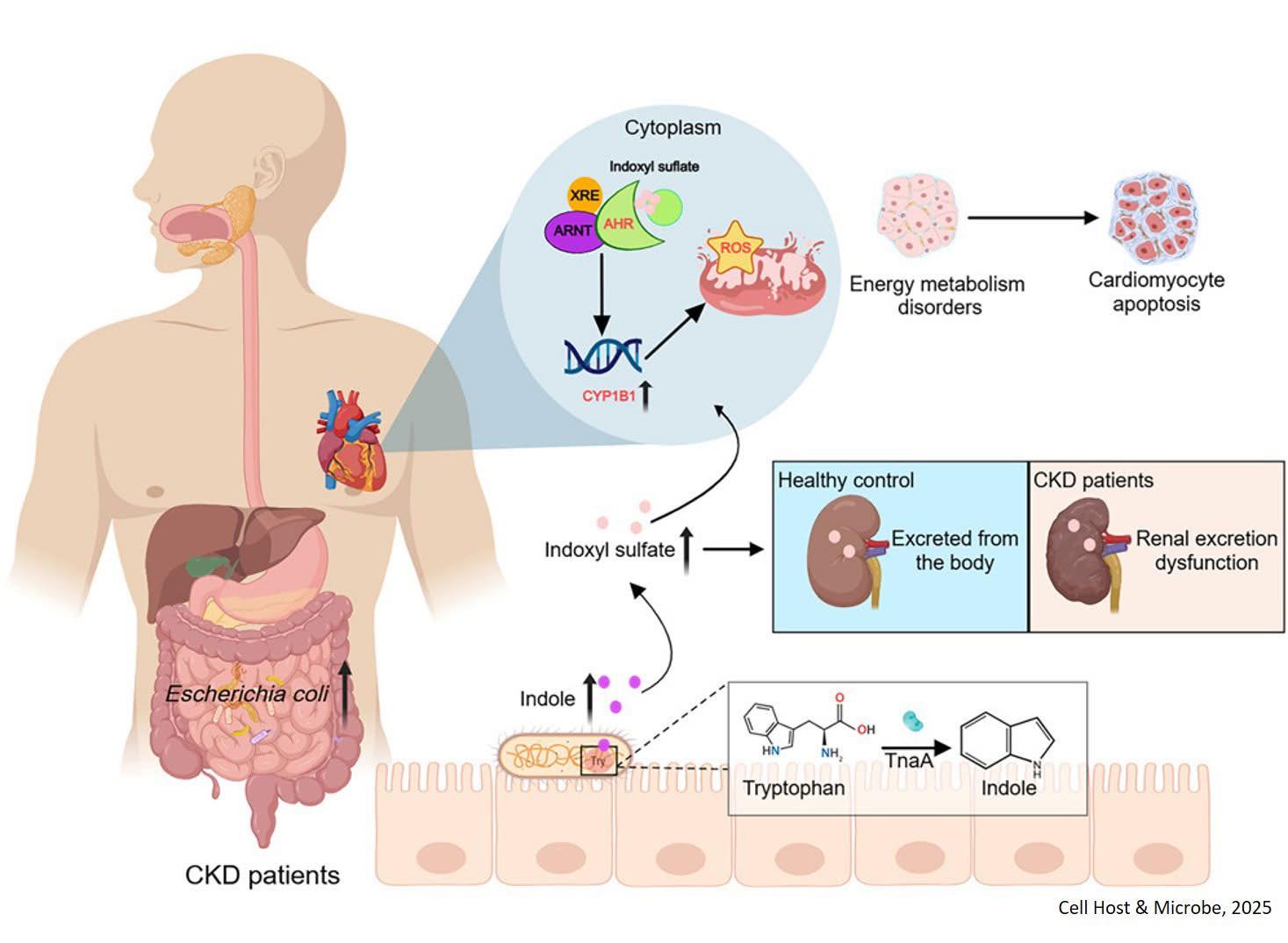 Dr. Muhammed - Mechanism of heart failure in chronic kidney disease ...