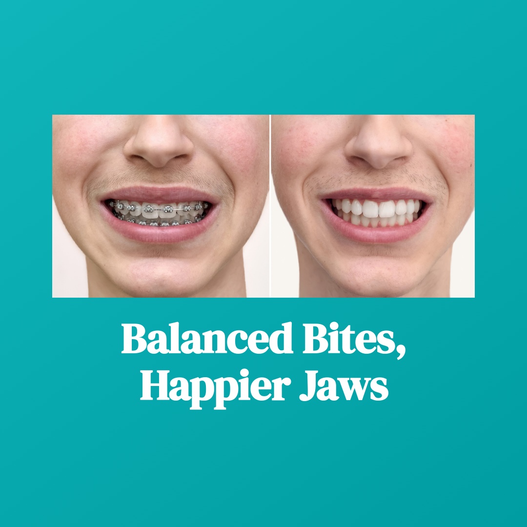 Smileville - Improved alignment can reduce jaw joint strain and ...