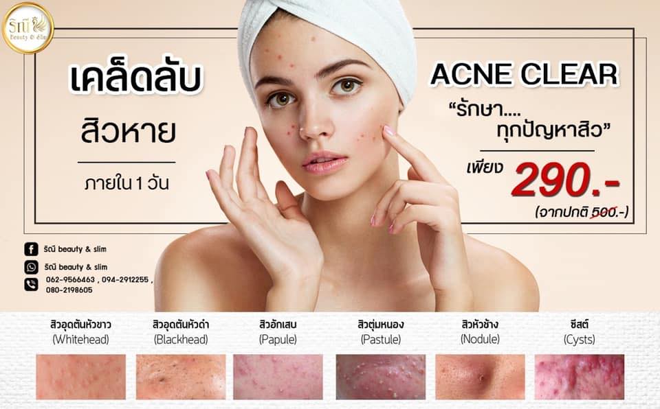 Bio Plus Clinic เพจหลัก - ปรับรูปหน้าโบท็อก ฟิลเลอร์ เลเซอร์ สิว/ฝ้า ...