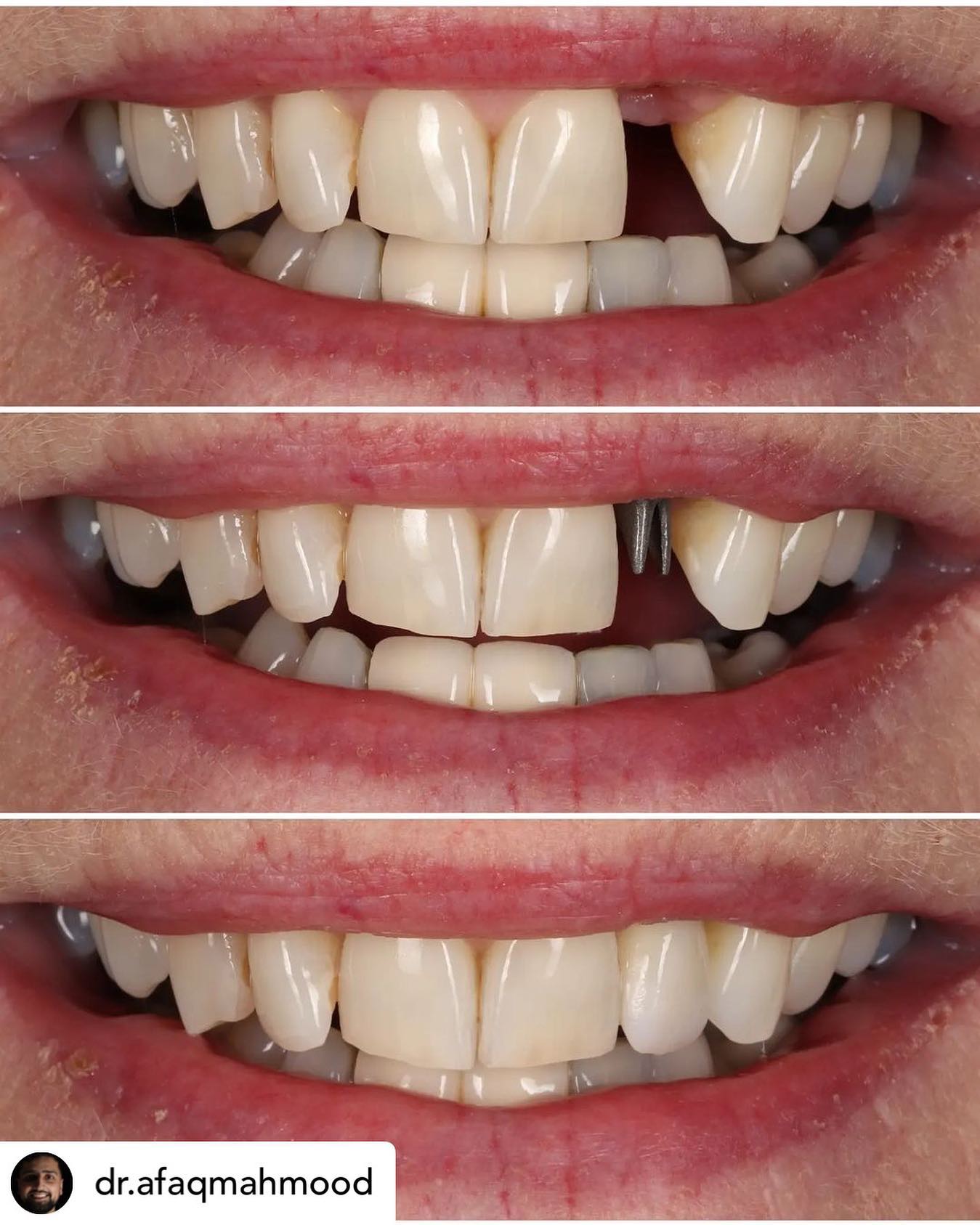 Matrix Dental Laboratory - Great work from @dr.afaqmahmood & @dr.nadeem ...