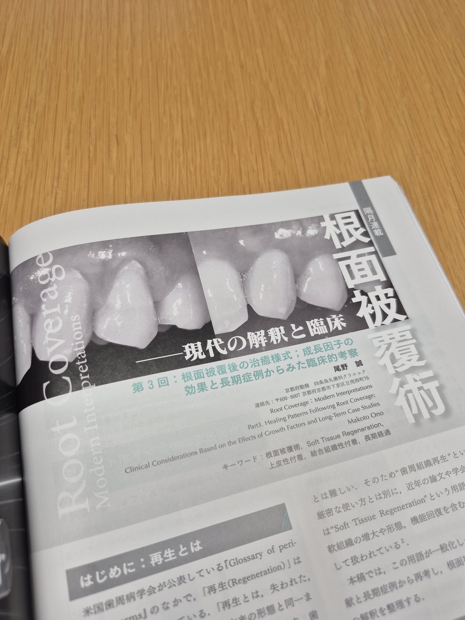 歯科臨床総合誌 ザ・クインテッセンス 2026年 2・3・4・5・7月号 5冊