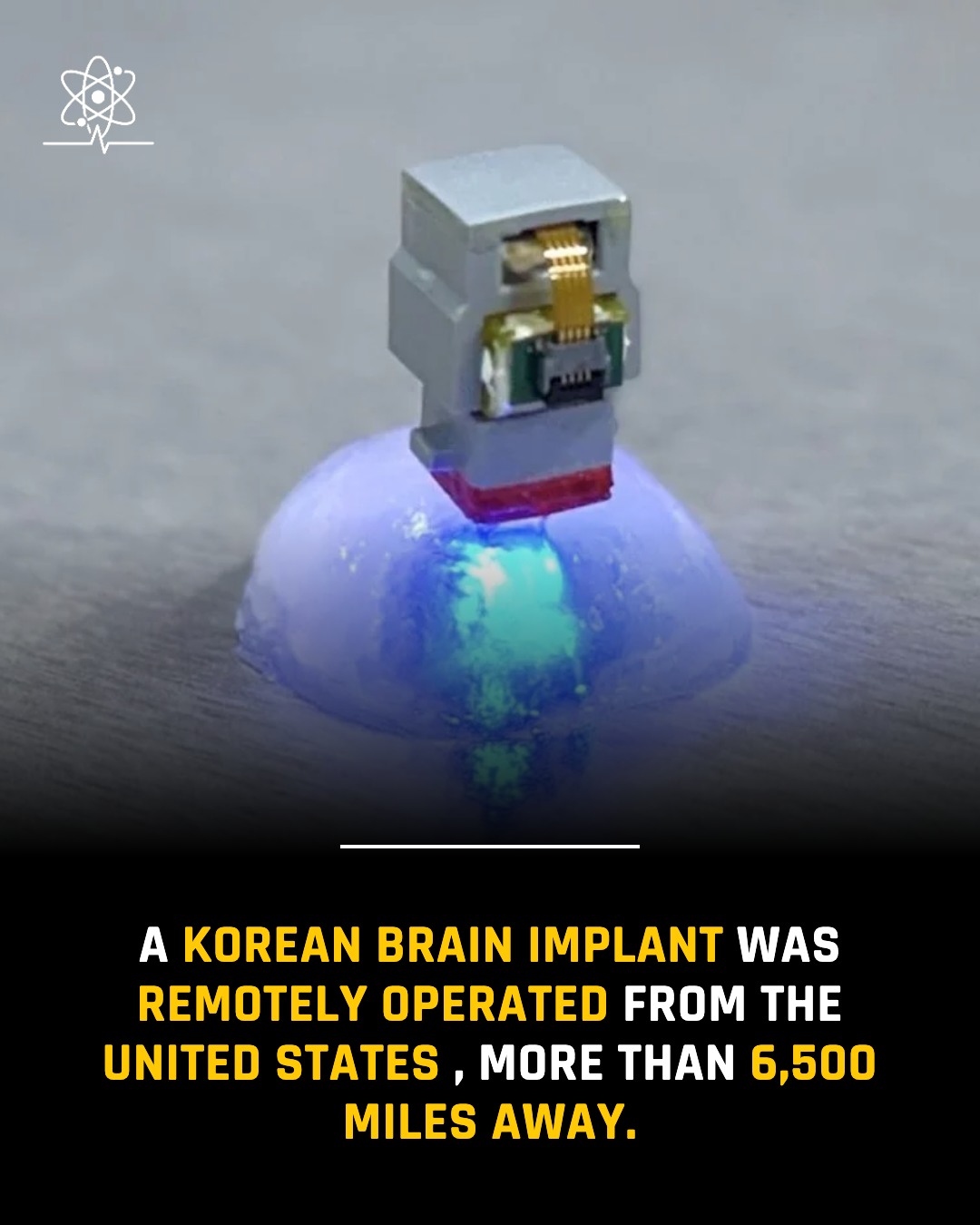 Researchers showed that a small wireless brain implant in South
