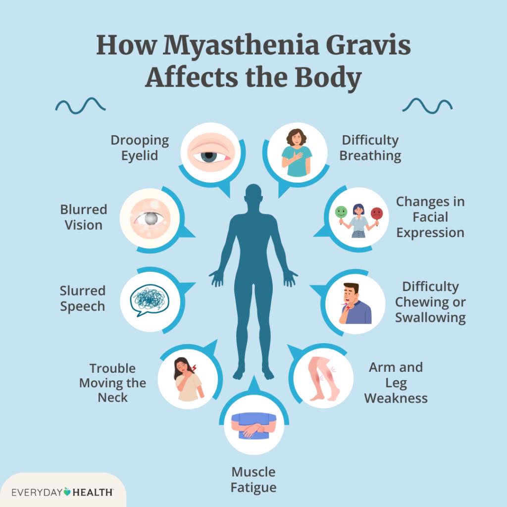 acetyl l-carnitine and myasthenia gravis Acetylcholine rich foods or supplements impact Gravis? Khloe Kardashian Poses Nude Count:150 Tablets Whitening skincare Korea