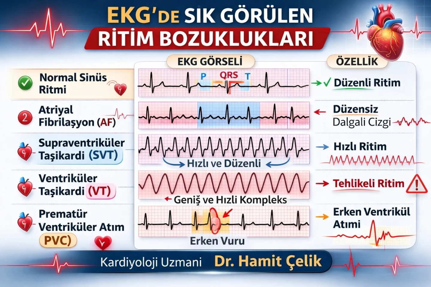 Kardiyoloji - Kalbin ritmi her zaman aynı değildir. EKG’de görülen bazı ...