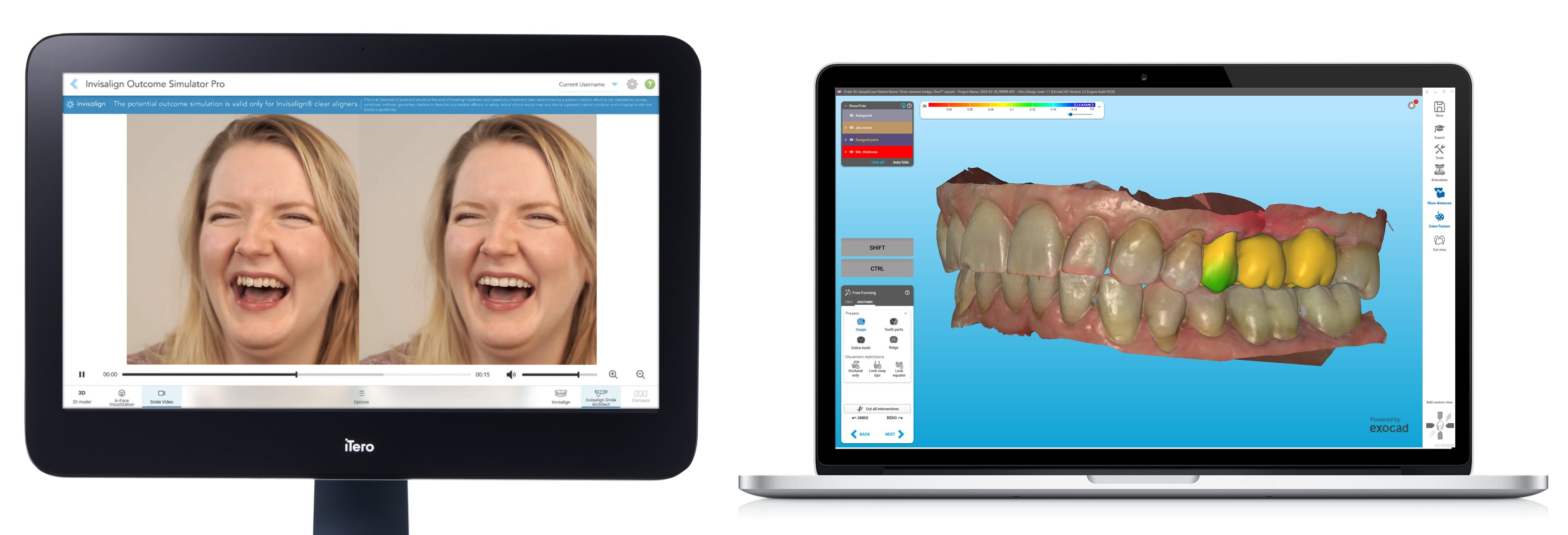 Align - Align Technology has announced a series of new product ...