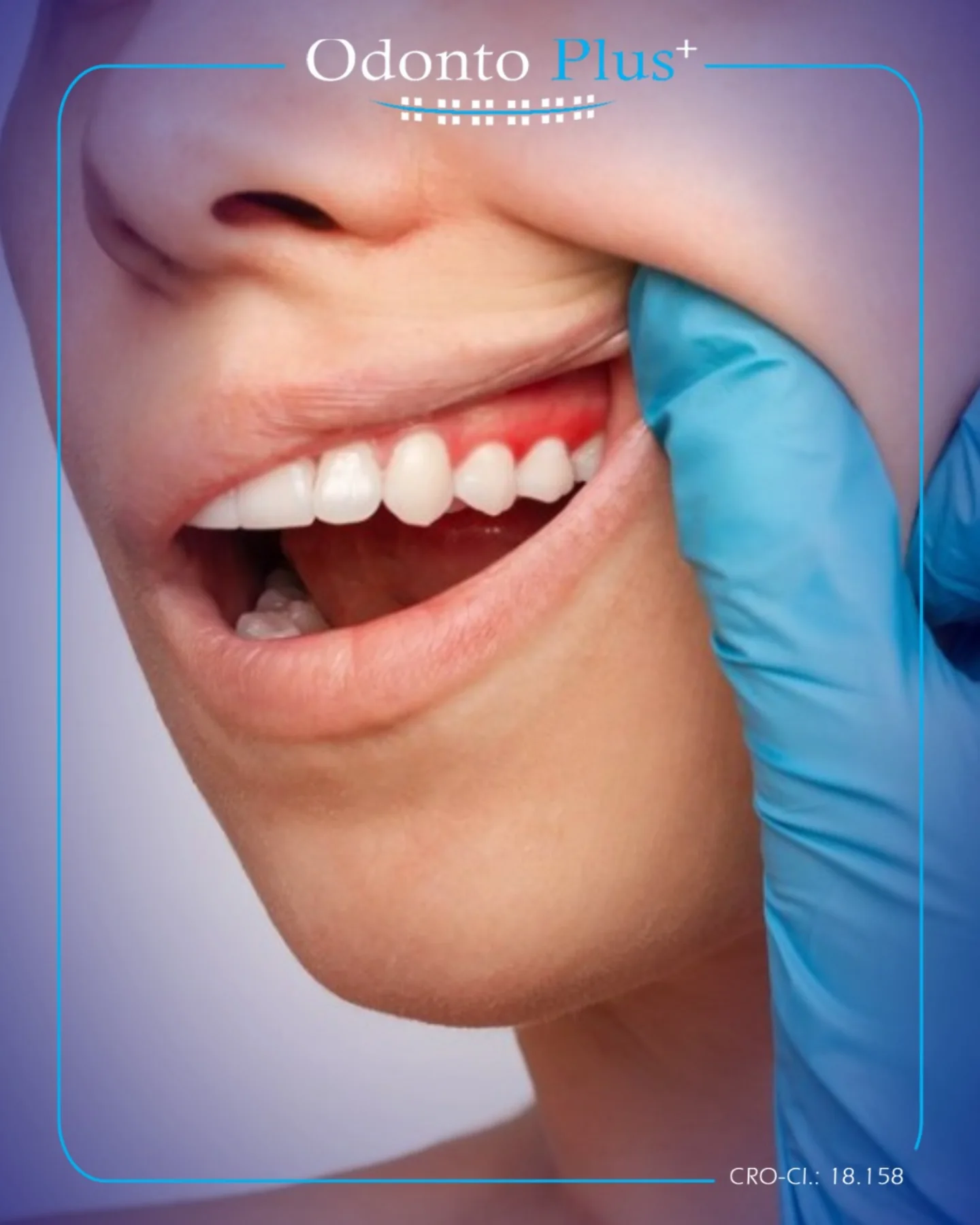Odonto Plus - Precisa passar por consulta ou fazer tratamentos ...