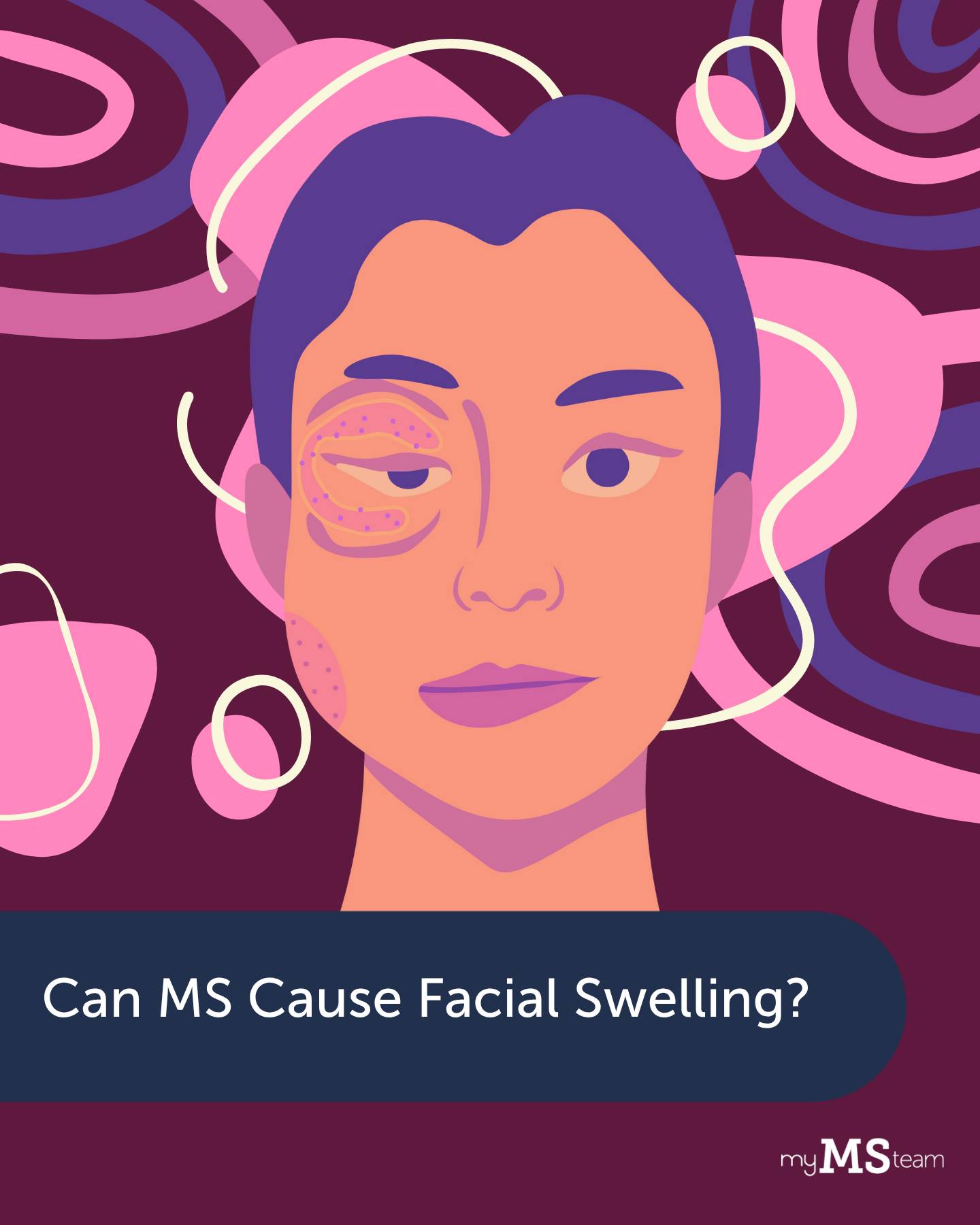 MyMSTeam - Apart from common symptoms of #MultipleSclerosis (MS), some ...