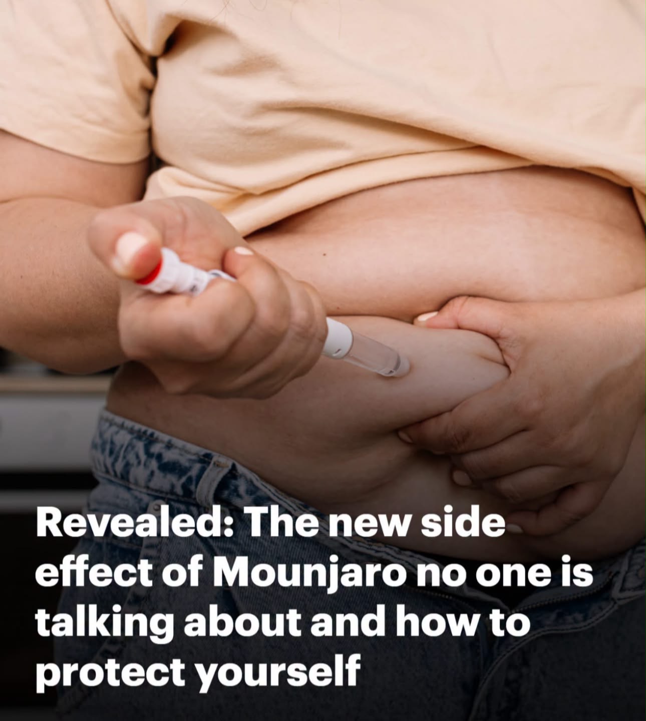 🚨 MOUNJARO USERS REPORT HAIR LOSS — HERE'S WHAT RESEARCH SAYS ABOUT THE SIDE EFFECT People taking the popular diabetes and weight-loss medication Mounjaro (tirzepatide) are reporting an unexpected problem: hair loss