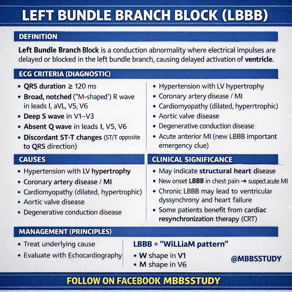 MBBS - Left Bundle Branch Block (LBBB) is an important ECG conduction ...