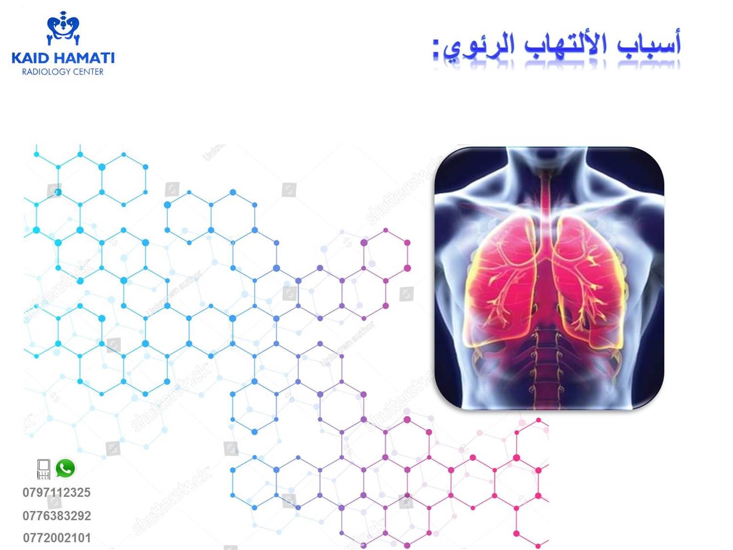 مركز كايد حماتي لتصوير الاشعة يحدث الالتهاب الرئوي عندما تتسبب مادة مهيجة في حدوث التهاب في الحويصلات الهوائية الدقيقة في الرئتين يسبب الالتهاب صعوبة في مرور الأكسجين عبر الحويصلات الهوائية في