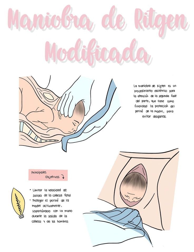 Reyna - #obstetricia #maniobraritge #embarazo #mujer ⛔☺️👉La Maniobra de ...