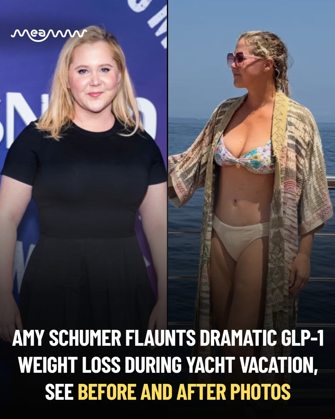 Amy Schumer has lost 50 pounds following Cushing syndrome diagnosis in 2024, with the help of GLP-1 medication Mounjaro, and has now shared some stunning bikini photos on her Instagram