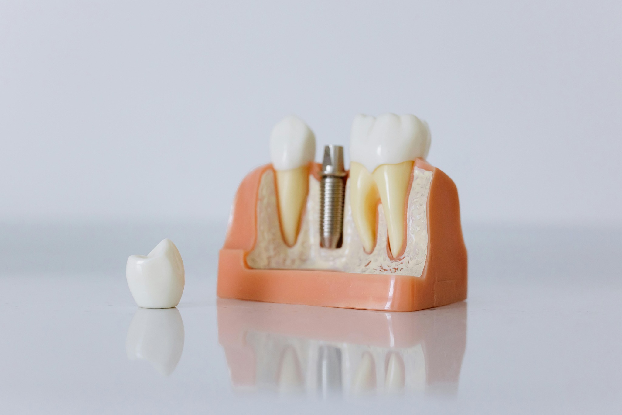 Dental Assistant School of Maryland | Burtonsville MD