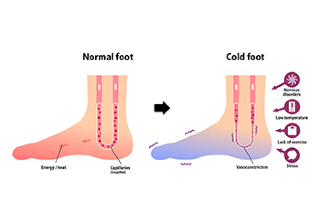 Tarpley - Cold-related foot injuries, such as frostbite, chilblains ...