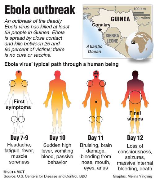 Ebola Virus Disease Signs Symptoms Treatment And Prevention Stages Of Ebola Facebook