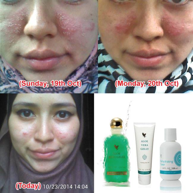 Testimoni Diri Sendiri Forever Living Products Facebook