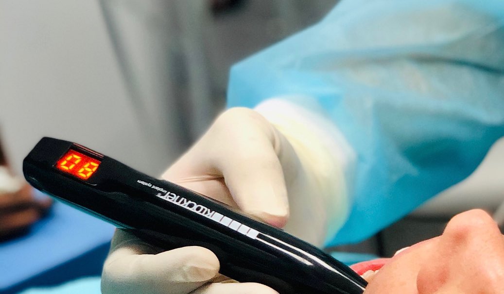 Springs Dental - The implant stability quotient (ISQ) is... | Facebook