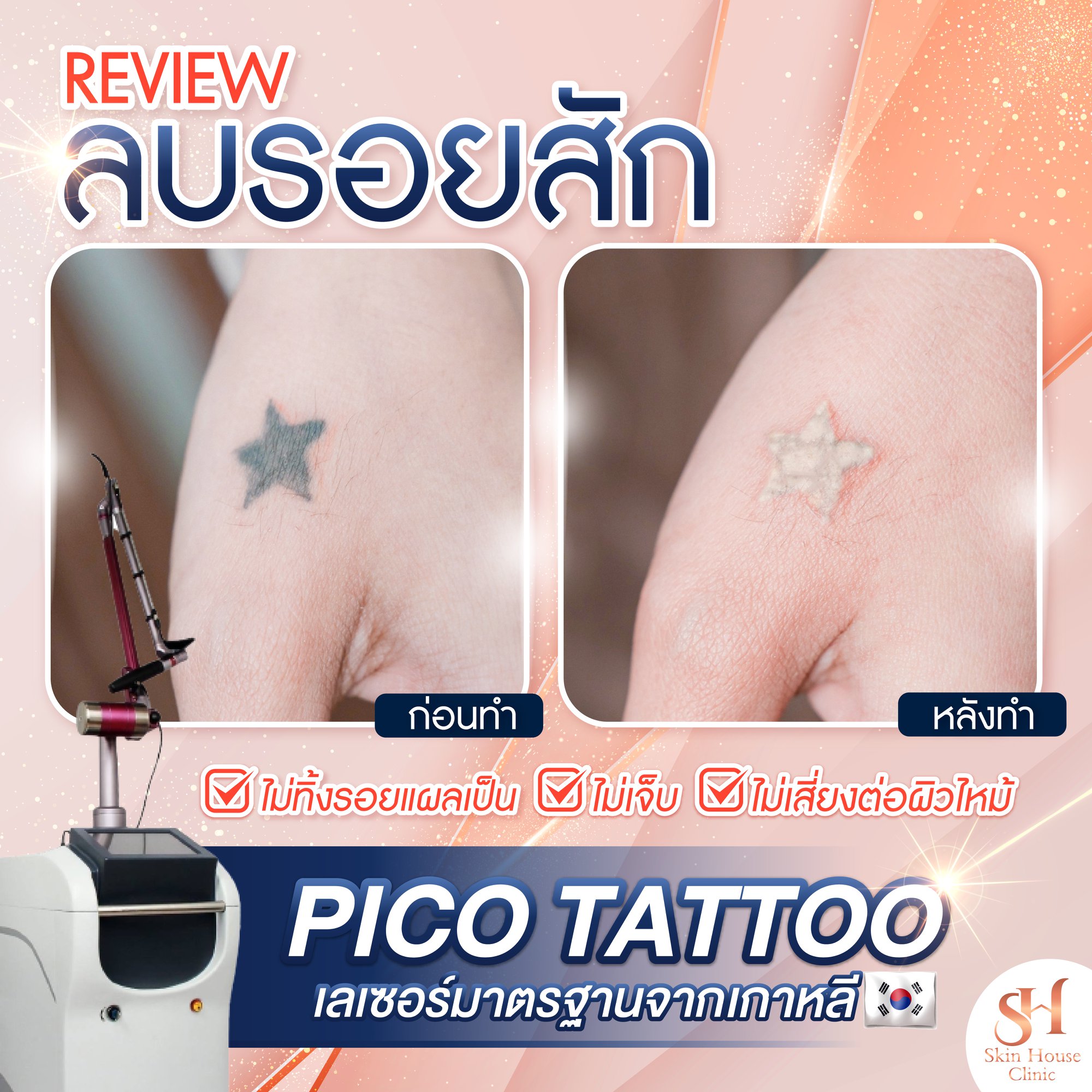 Pico Second Laser คืออะไร ?... - Skin House Clinic ทองหล่อ | Facebook