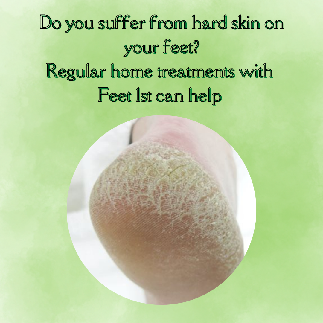 Feet 1st - Do you suffer from hard skin on your feet? No...