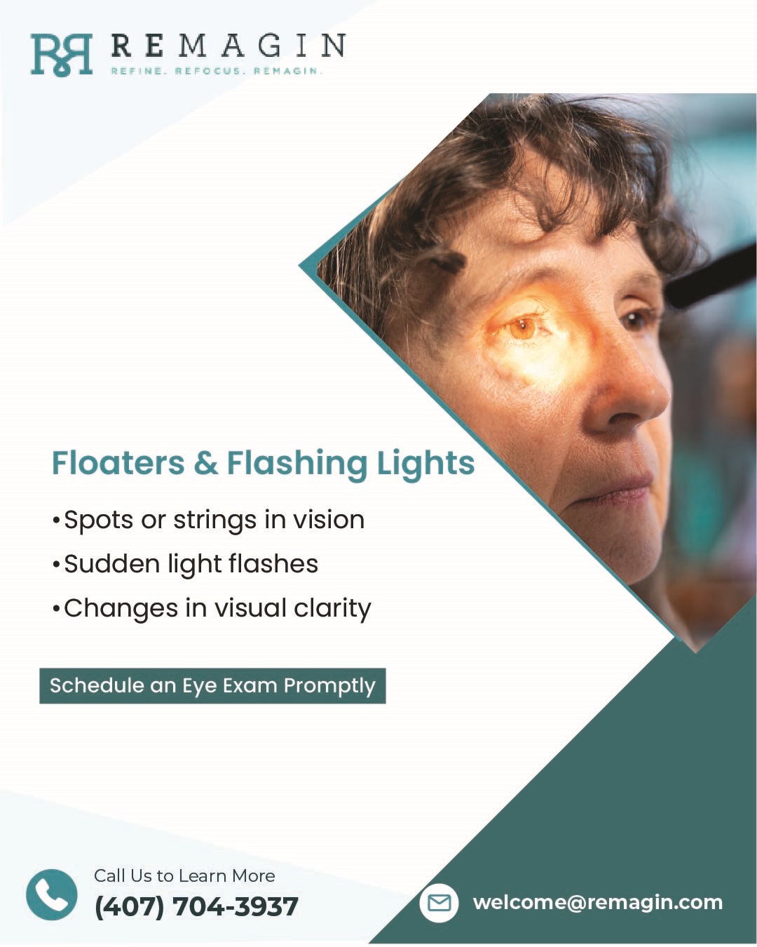 Remagin - Floaters and flashing lights are often harmless, but sudden ...