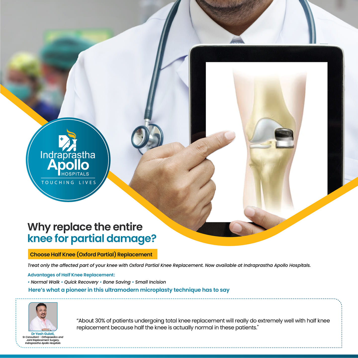 Apollo - The Oxford Partial Knee implant, a less painful and more rapid ...