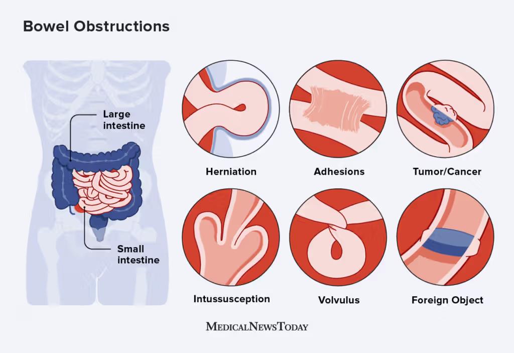 where can i take my tirzepatide shot 5 Tips for Taking Zepbound (Tirzepatide) Injections for Weight Loss Size:3 Gallon Pot Natural Ways to Increase brand:biocare