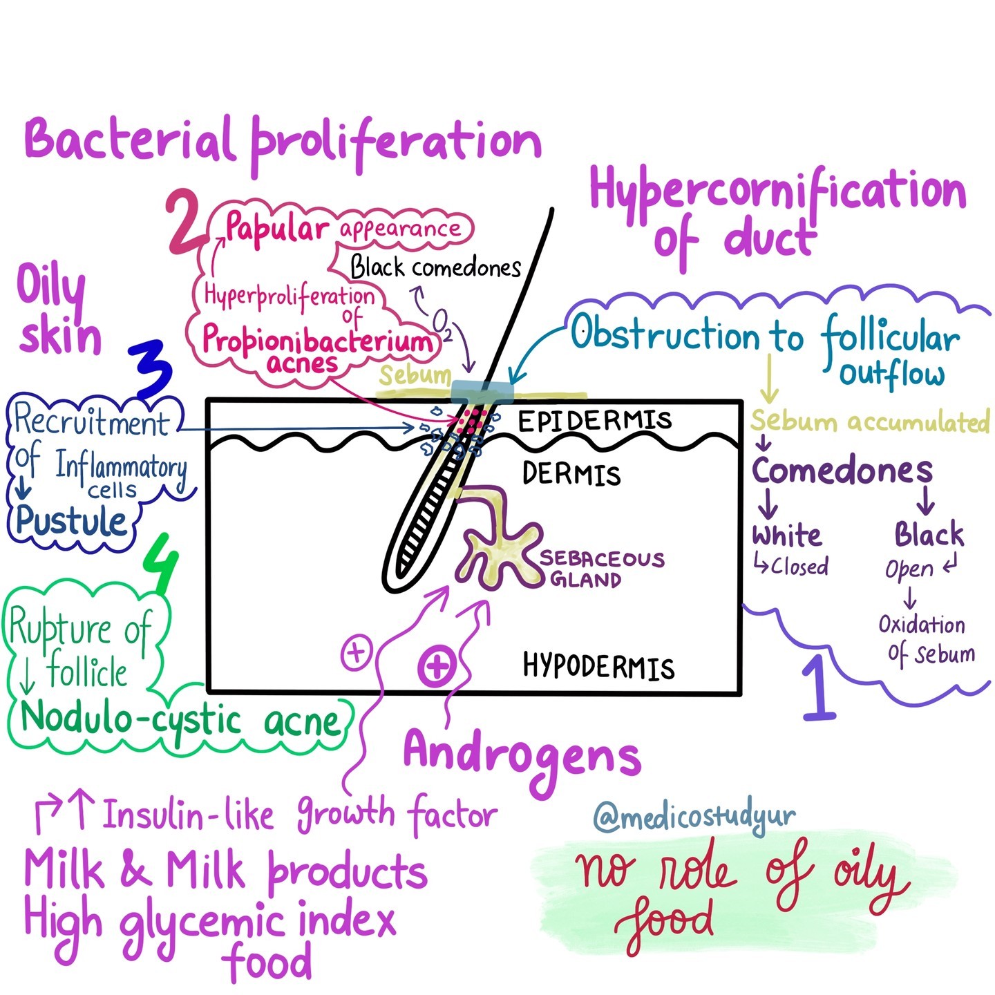 Pathophysiology of acne. Everything... - Medico Study Streams | Facebook