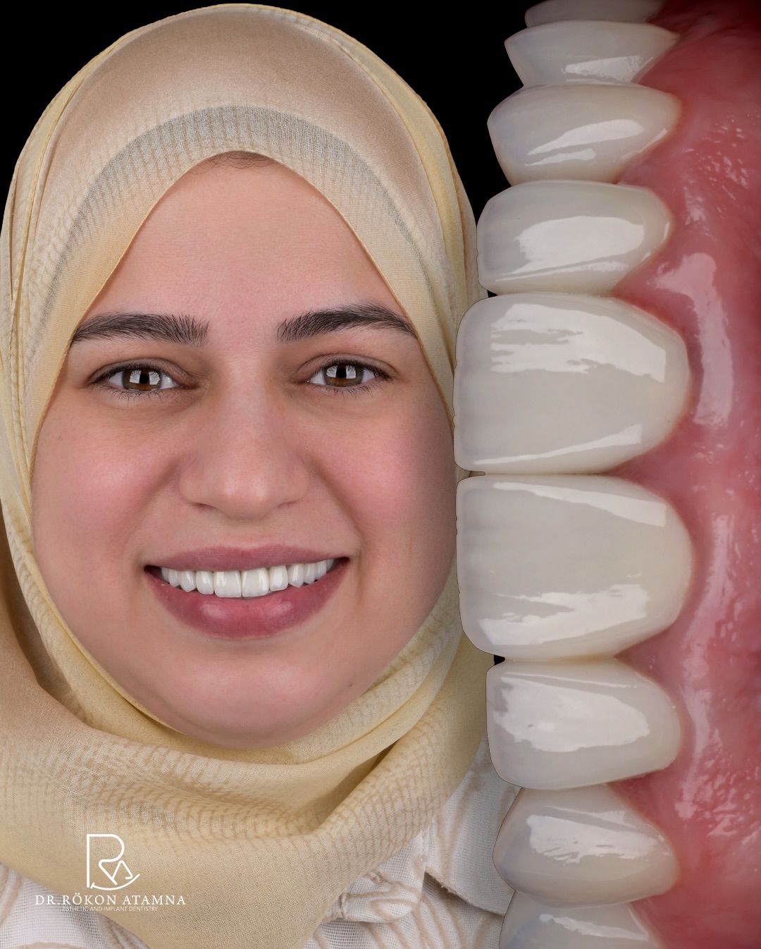 ד״ר רוכון עתאמנה Dr. Rokon Atamna | Hod HaSharon