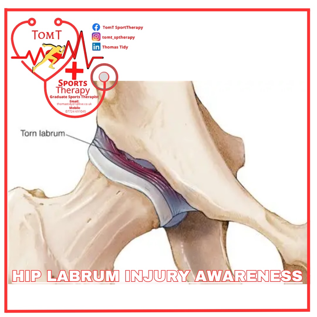 🦵 Deep hip pain that won’t settle?... - TomT Sport Therapy | Facebook