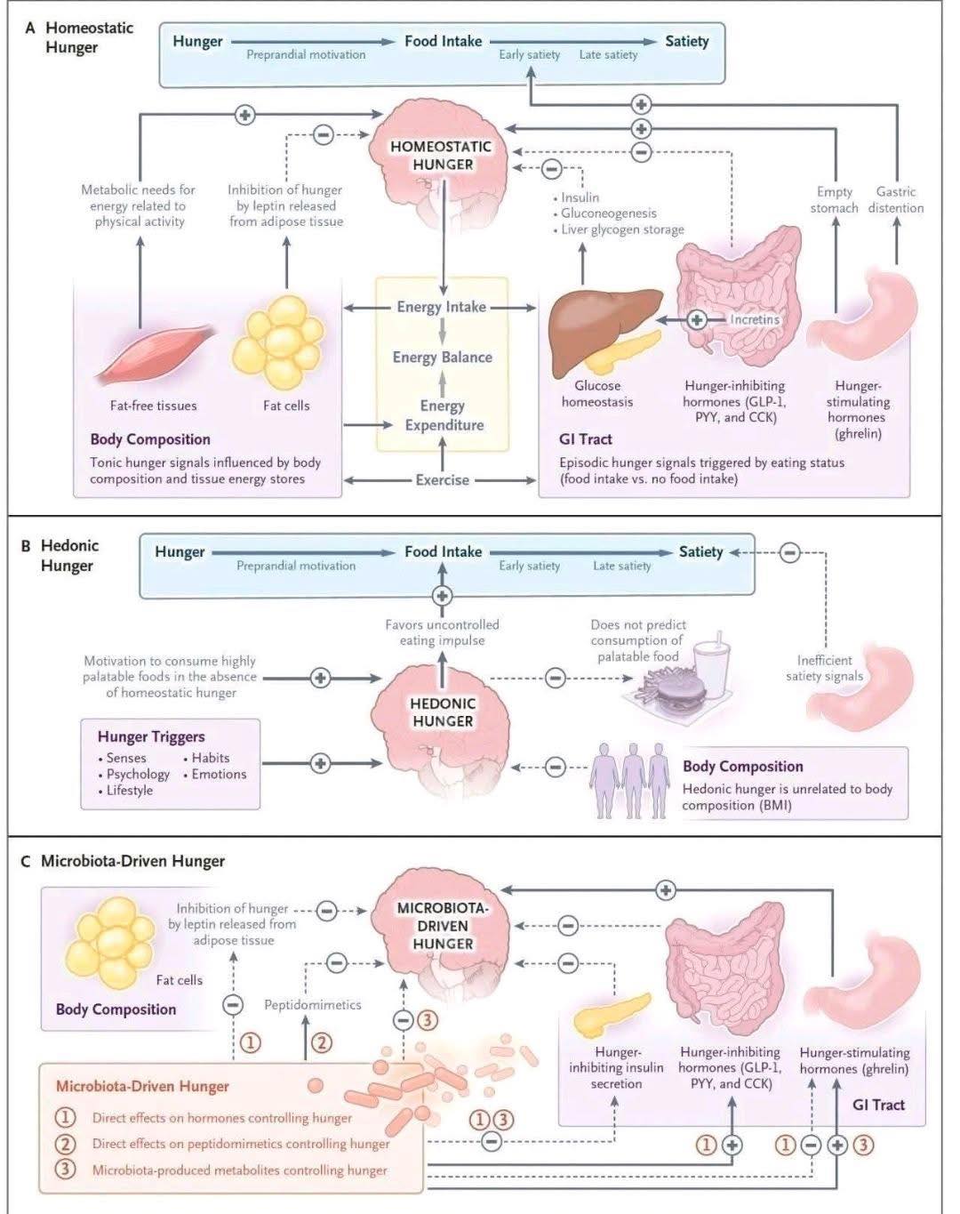 Dr. Muhammed - 3 types of hunger explained 