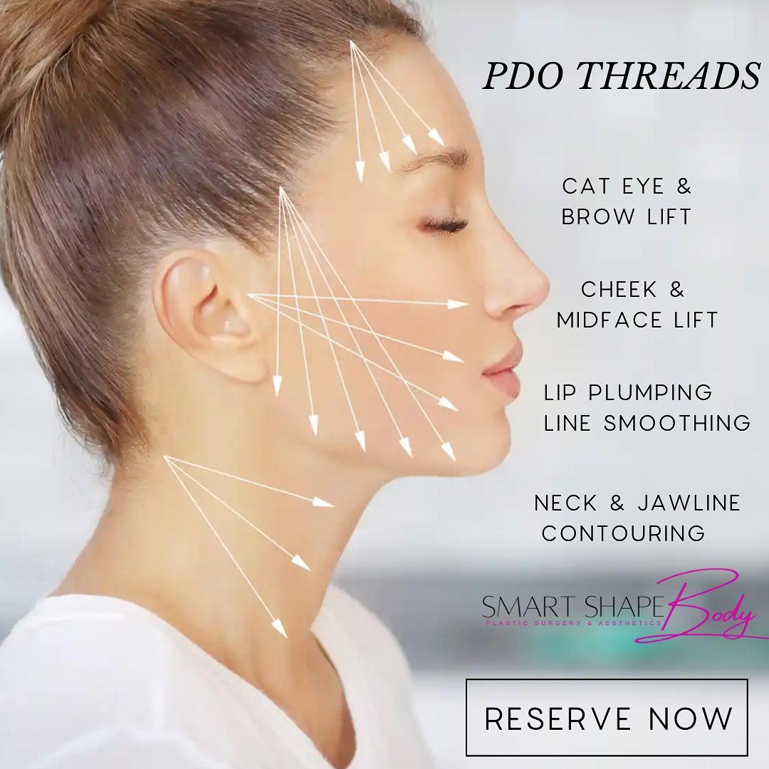 10% off ALL PDO Thread Lifts with... - Smart Shape Body | Facebook