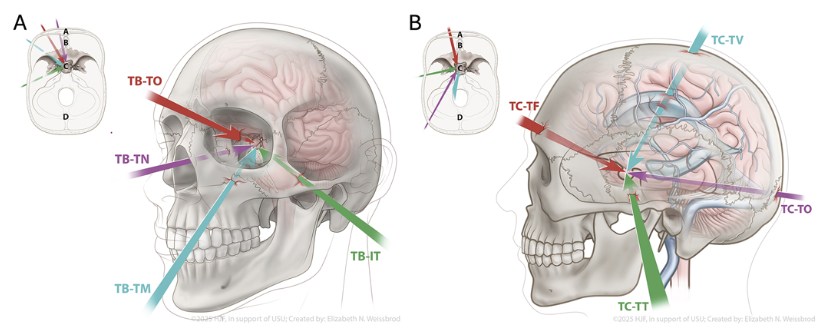 Journal - #NeurosurgicalAtlas: Step-by-step instructions and ...