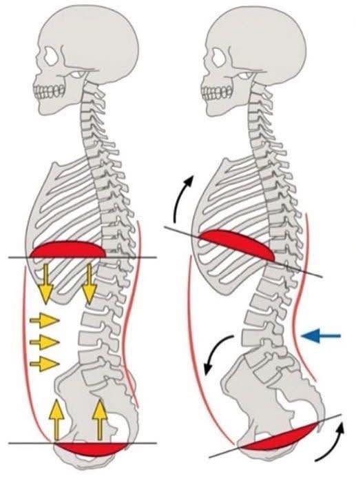 📌 Rib Cage Position, Pelvic Tilt &... - Dr. Muhammed Ziya | Facebook
