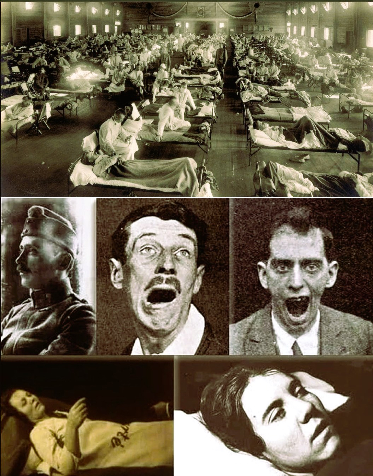some-the-forgotten-sleeping-epidemic-the-plague-that-froze-the