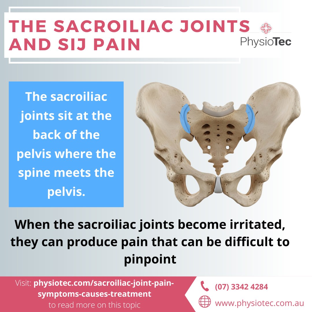 PhysioTec - Ever heard of SIJ pain? 👀 Sacroiliac joint pain (aka “SI ...