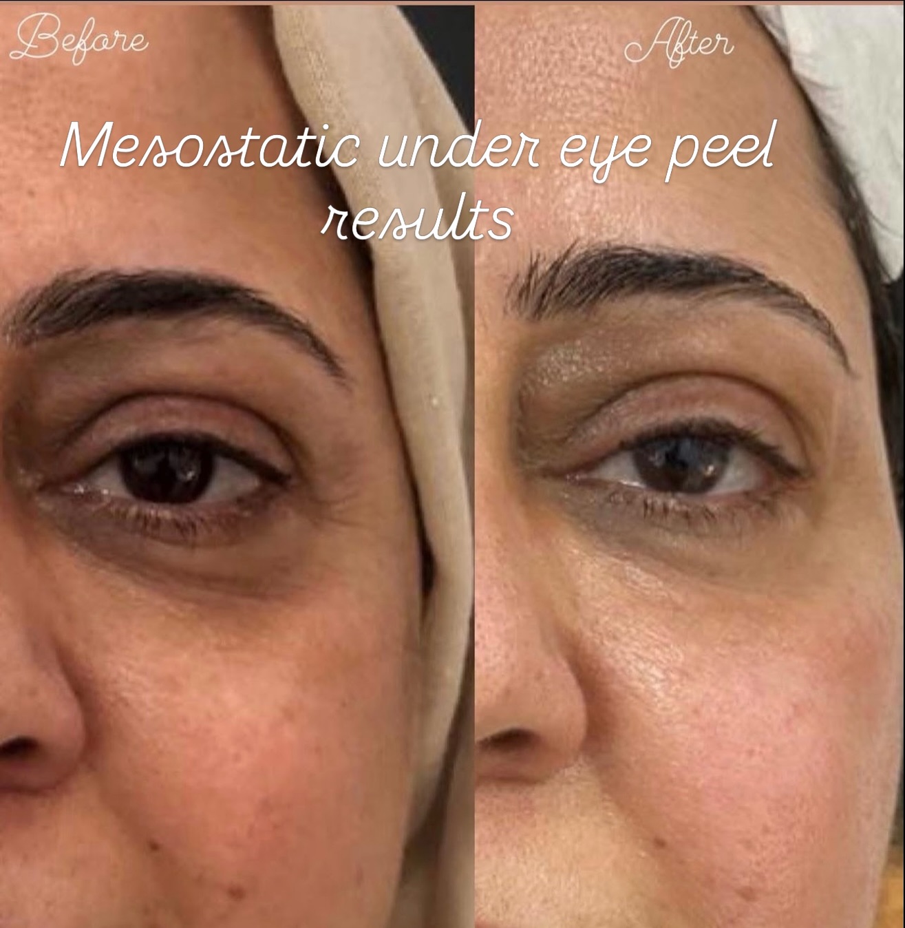 When life gets busy, your health shouldn't suffer. Glutathione injections deliver powerful antioxidants directly to your bloodstream, helping with skin clarity, immunity, and overall wellness. Book your session today! ☎️ 289 812