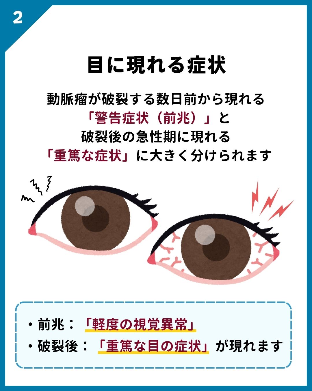 くも膜 下 出血 前兆 チェック