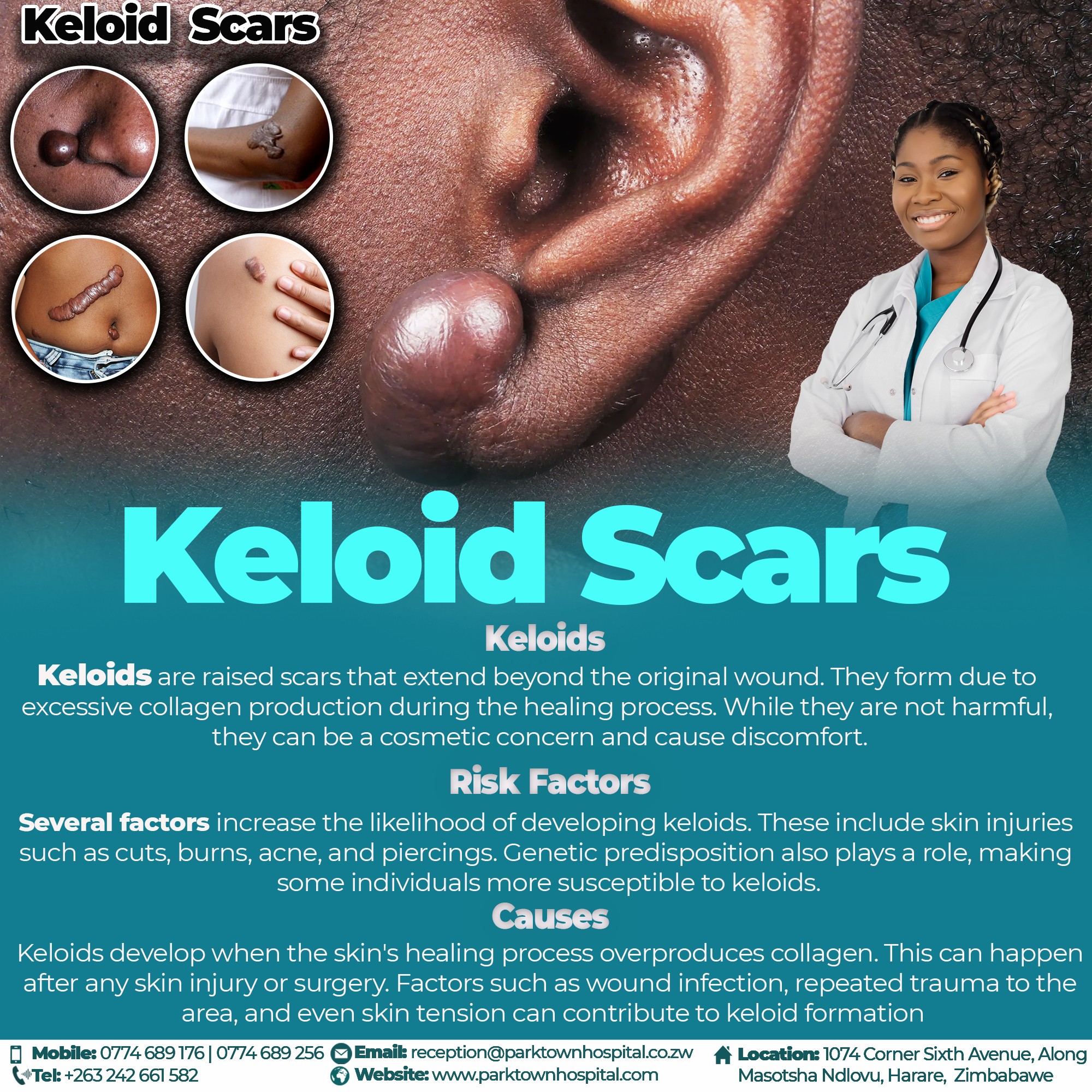 Parktown - #KeloidsScars👨🏽‍⚕👩🏽‍⚕ Keloids are raised scars that extend ...