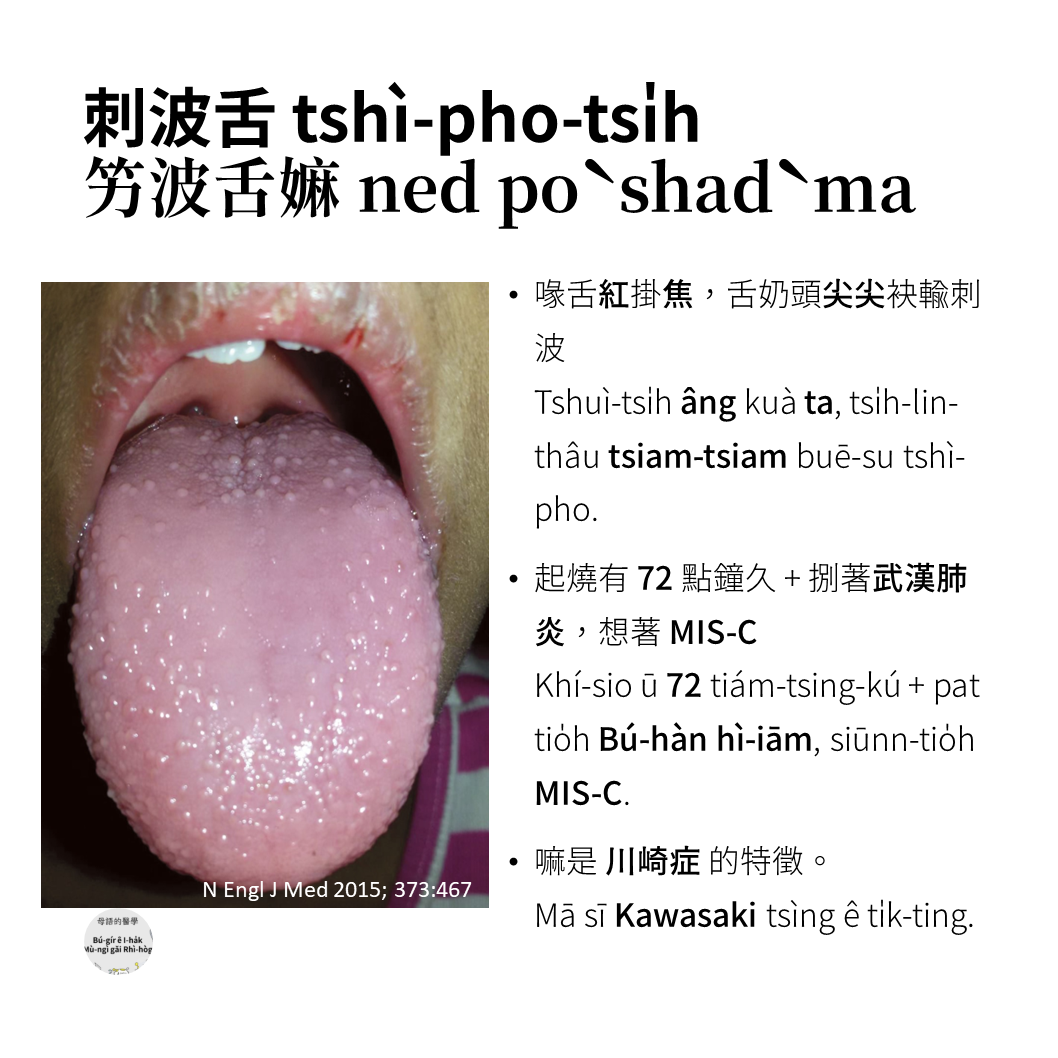 母語ê/gǎi醫學 - 115-1 #刺波舌 tshì-pho-tsi̍h (客) 竻波舌嫲 ned...