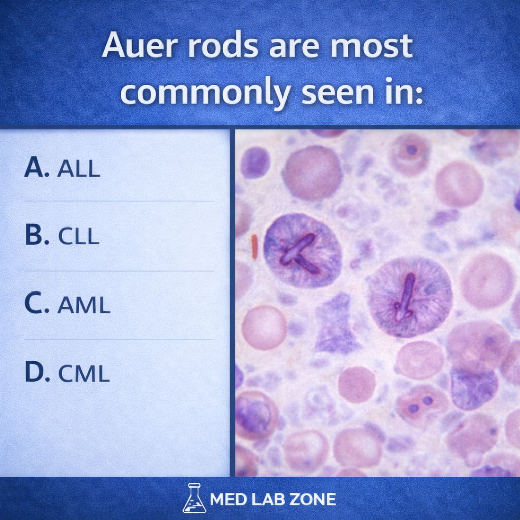 MED LAB ZONE - Auer rods are a classic exam favorite 🔬 But... | Facebook