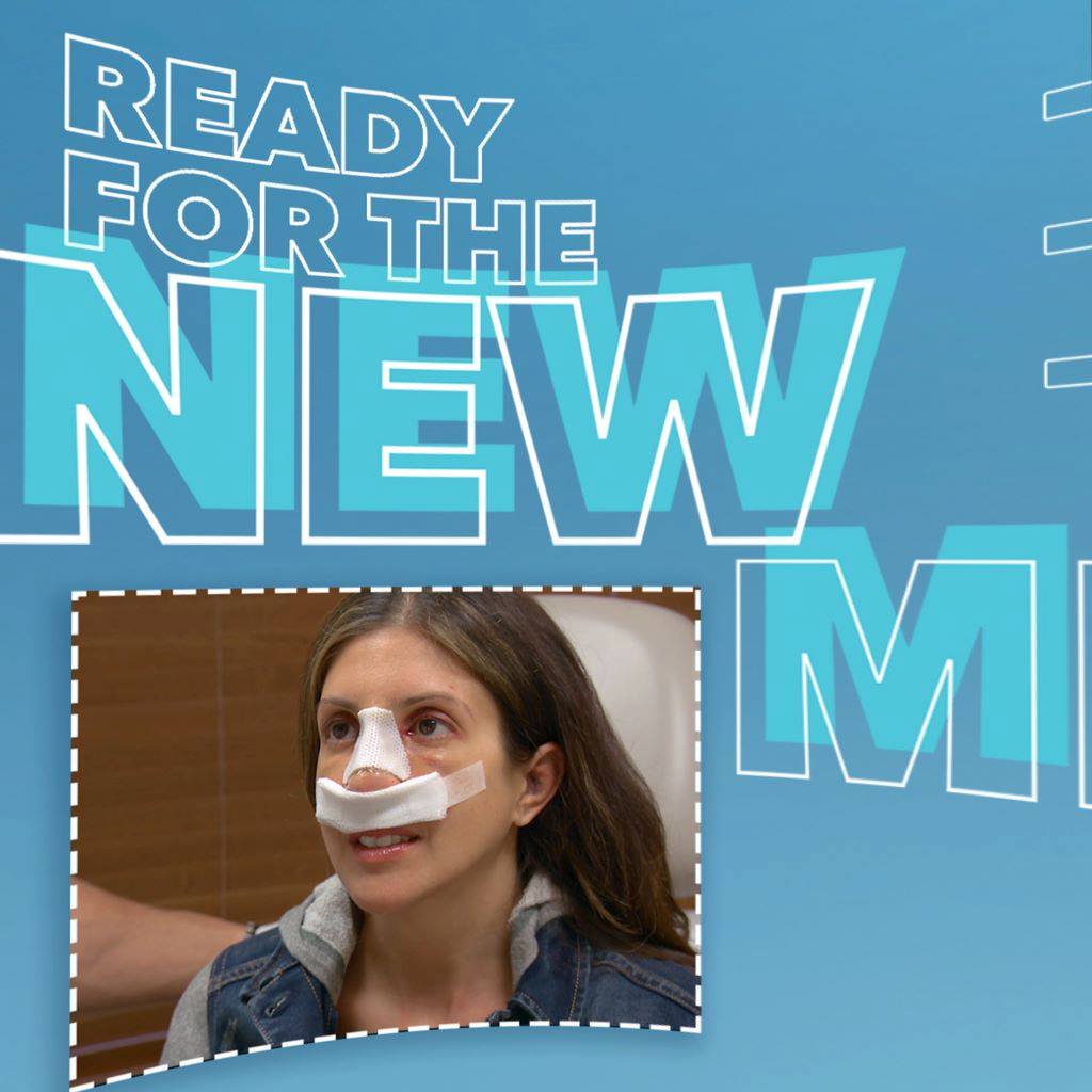 Botched - Jessica and her nose are a perfect match! 👃
